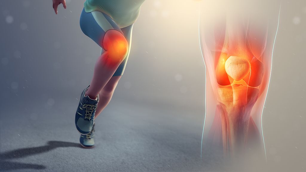 A 3D medical animation still shot illustrating the medical condition known as Runner's knee.